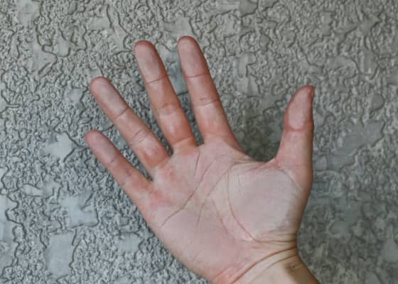 白華現象を確認するために壁を触った手の平